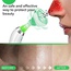 Pore Vacuum Blackhead Remover (B07F1YS3NB), Amazon Price Drop Alert, Amazon Price History Tracker